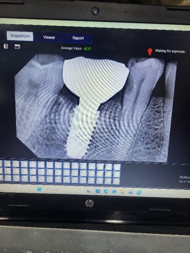 Xray