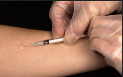 Acne Treatment, Vaccination,Diet Planning